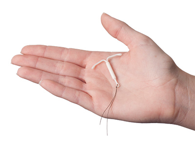 Hormonal IUD